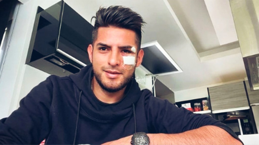 #FÚTBOL | DEFENSOR DE BOCA RECIBIÓ 15 PUNTOS DE SUTURA DESPUÉS DE FUERTE CHOQUE EN UN&nbsp;ENTRENAMIENTO