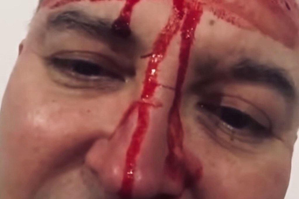 #ESCÁNDALO | LEO GARCÍA: LA POLICÍA TILDÓ LA AGRESIÓN AL MÚSICO COMO «UNA PELEA DE&nbsp;BORRACHOS»