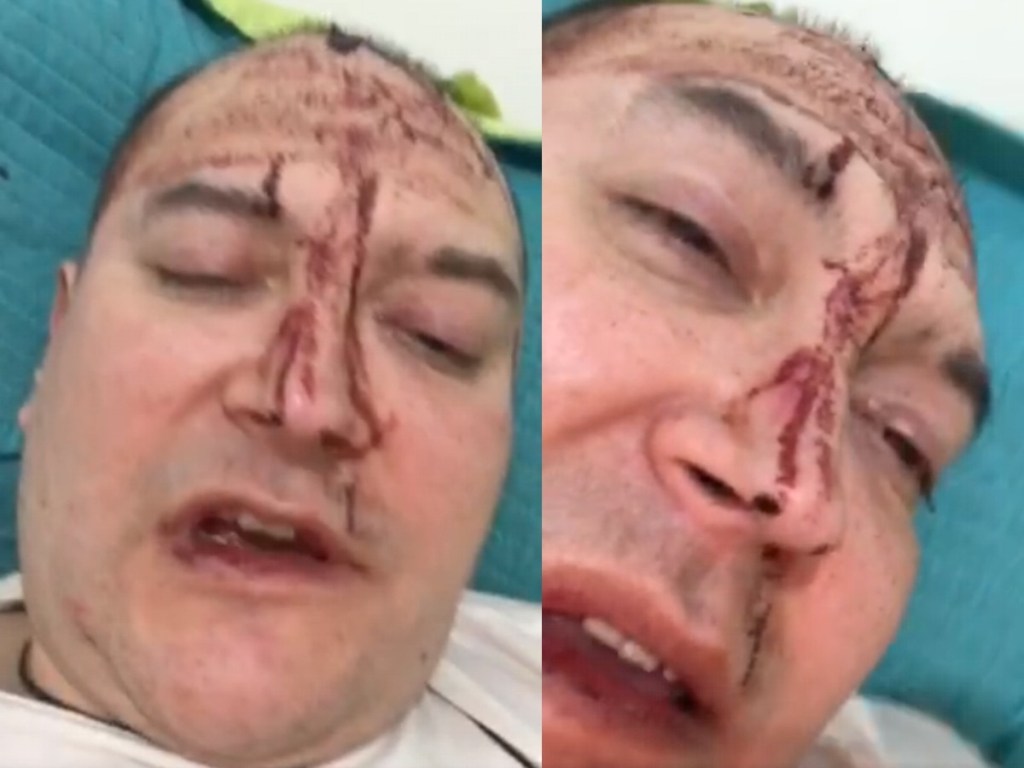 #HOMOFOBIA | SALVAJE AGRESIÓN AL MÚSICO LEO&nbsp;GARCÍA