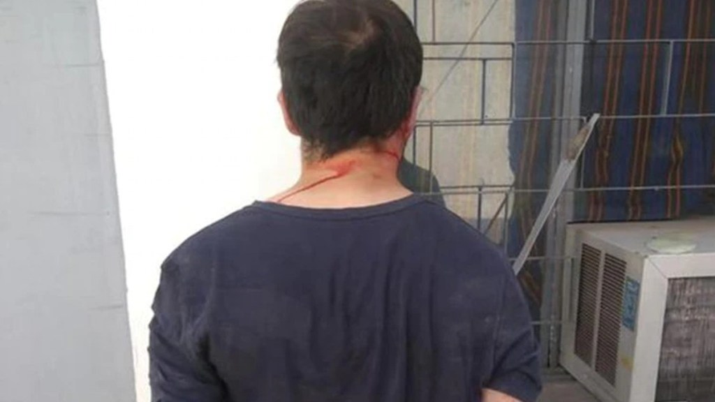 #POLICIALES | ENTRÓ A LOS TIROS A UNA OFICINA QUERIENDO ASESINAR A UN EXCOMPAÑERO DE SECUNDARIA Y BALEÓ A UNA EMPLEADA EN LA&nbsp;CABEZA