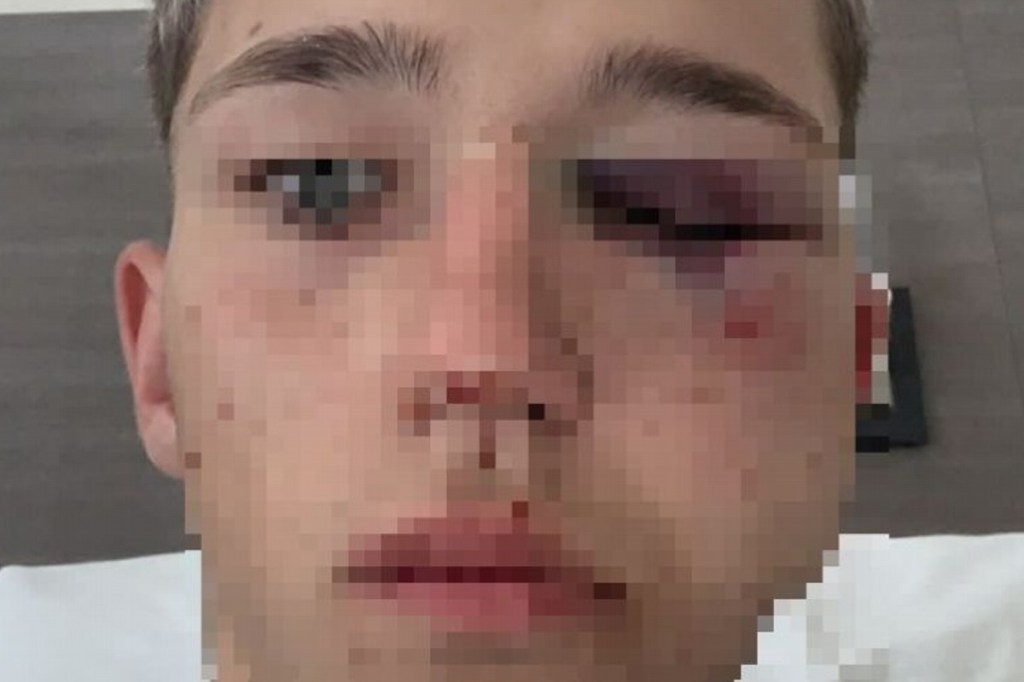 #POLICIALES | ADOLESCENTE DE 16 AÑOS GRAVEMENTE HERIDO AL SER ATACADO POR UNA PATOTA DE&nbsp;RUGBIERS