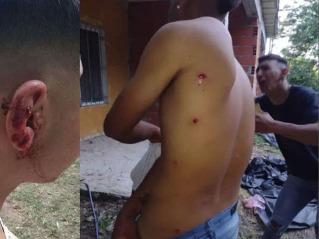 #PAÍS | INVESTIGAN A 25 POLICIAS POR DISPARARLE A 11 JÓVENES EN UNA&nbsp;FIESTA