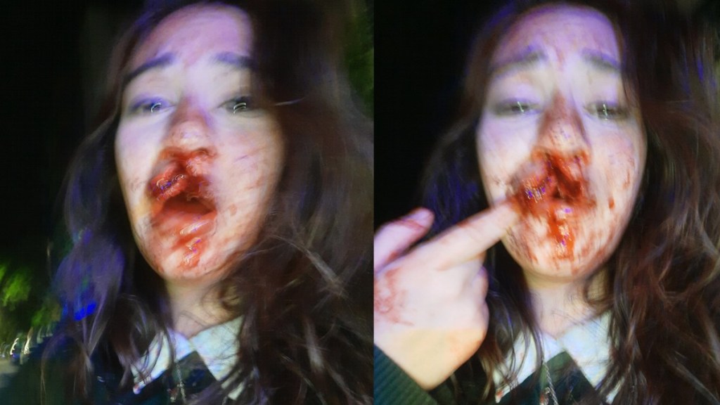 #POLICIALES | ABUSO POLICIAL: LOS CONFUNDIERON CON MOTOCHORROS Y LOS DESFIGURARON A&nbsp;GOLPES