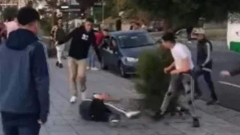 #POLICIALES | UNA PATOTA GOLPEÓ BRUTALMENTE A UN JUGADOR DE ALDOSIVI Y PODRÍA PERDER UN&nbsp;BRAZO