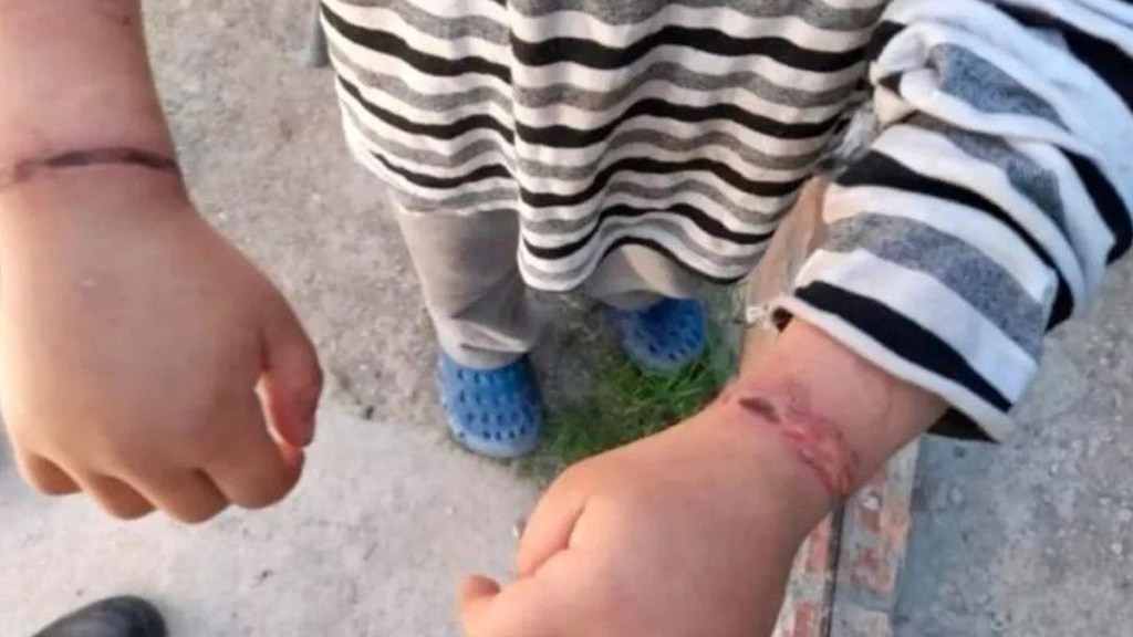 #POLICIALES | HABLÓ EL PADRE DEL NENE TORTURADO: “LA MADRE ME LO SACÓ PARA HACERLE&nbsp;ESTO”