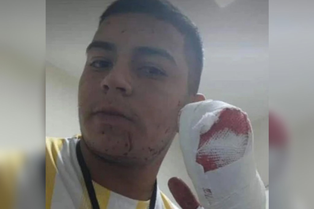 #POLICIALES | DELINCUENTE LE ARRANCÓ DE UN MACHETAZO CUATRO DEDOS DE UNA MANO A UN&nbsp;REPARTIDOR