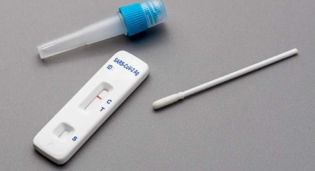 #SALUD | ¿CÓMO FUNCIONAN LOS TEST DE AUTOEVALUACIÓN DE&nbsp;COVID-19?