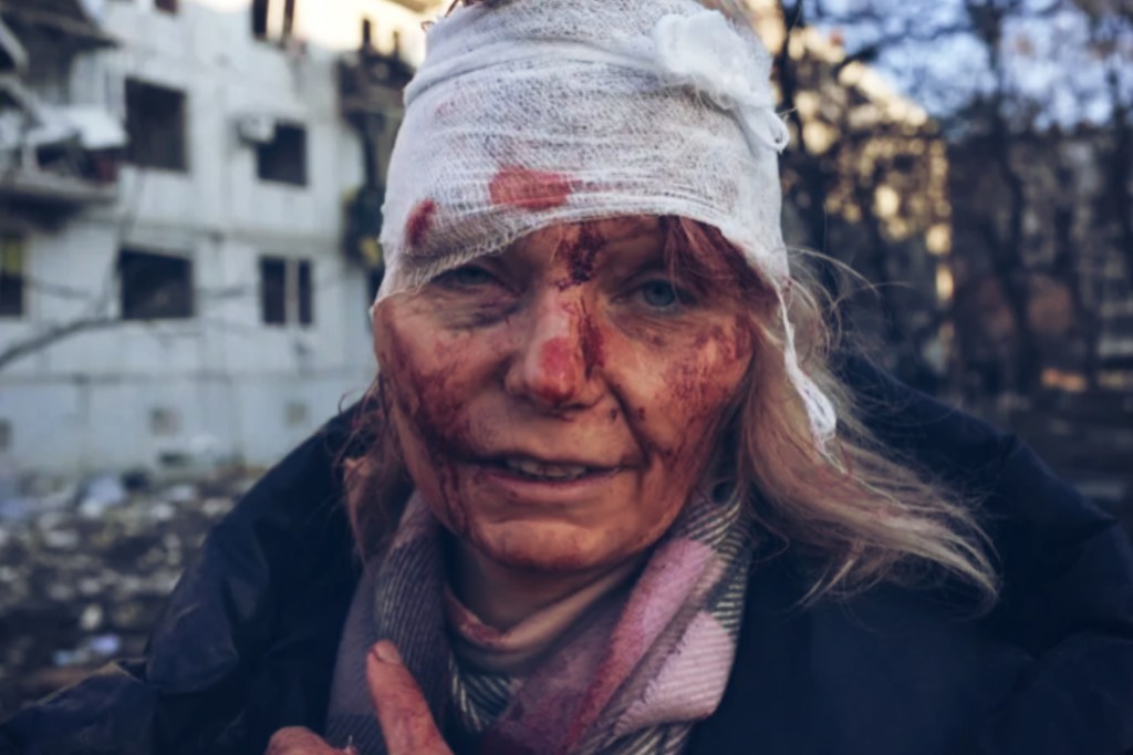 #GUERRA | 137 MUERTOS Y 316 HERIDOS EN UCRANIA POR LOS BOMBARDEOS&nbsp;RUSOS