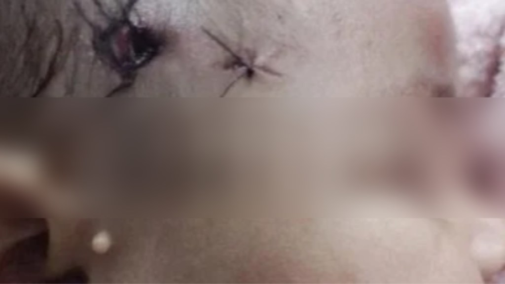 #BRUTAL | UNA BEBÉ DE CINCO MESES FUE BALEADA EN LA CABEZA POR LA&nbsp;POLICÍA