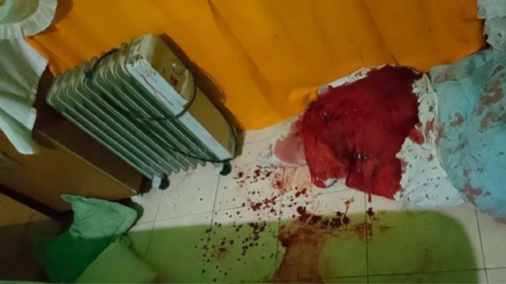 #HORROR | UN HOMBRE APUÑALÓ A SU ESPOSA, PENSÓ QUE ESTABA MUERTA Y MANDÓ UN MENSAJE QUE LE SALVÓ LA&nbsp;VIDA