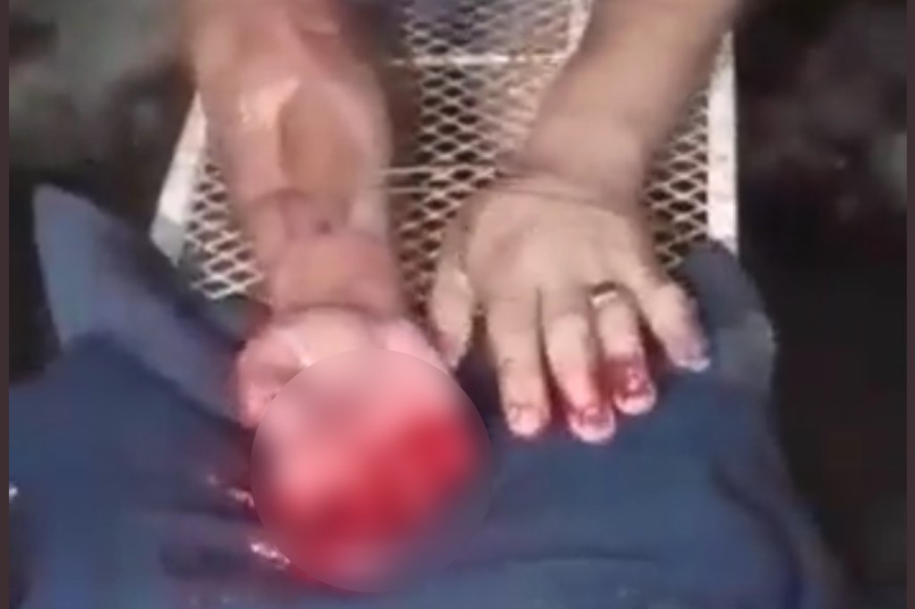 #HORROR | LE CORTARON 8 DEDOS DE LAS MANOS EN UN AJUSTE DE CUENTAS&nbsp;NARCO