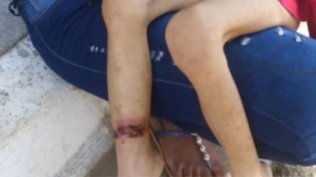 #HORROR | RESCATARON A UNA NENA DE 6 AÑOS QUE ESTABA ENCADENADA A UN&nbsp;ARMARIO