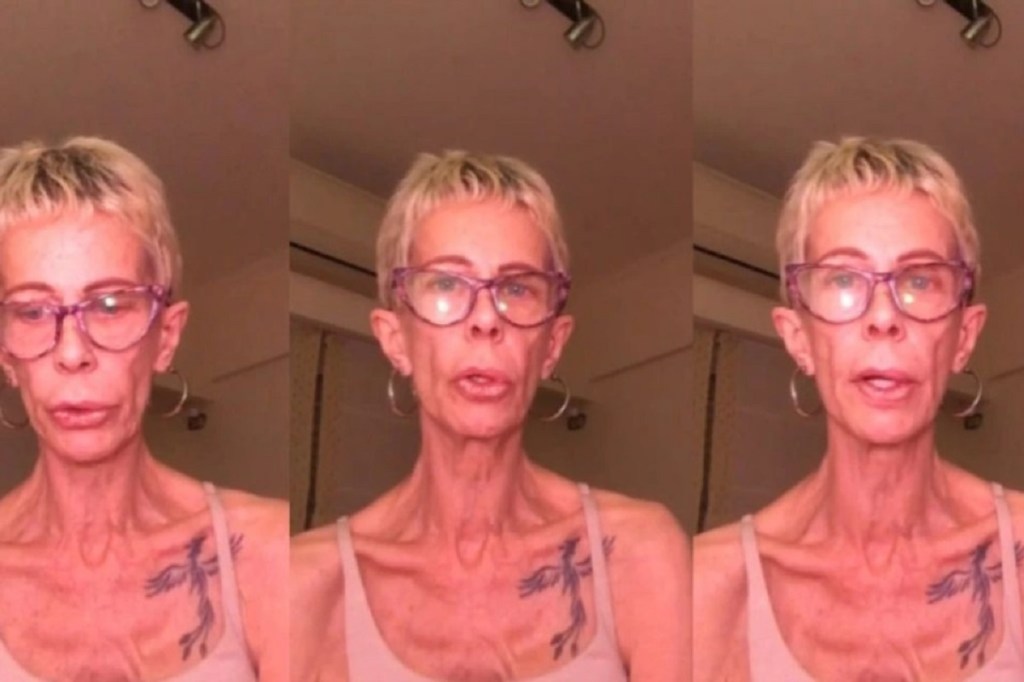 #SALUD | María Valenzuela pesa 35 kilos y exclama tras denunciar mala&nbsp;praxis