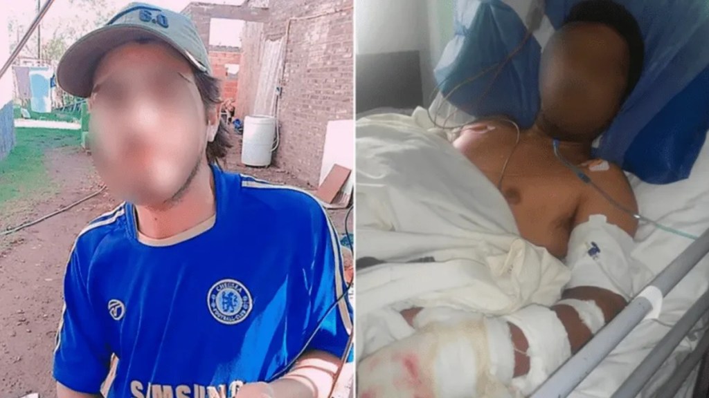 #HORROR | UN PACIENTE PSIQUIÁTRICO MURIÓ AL SER QUEMADO MIENTRAS ESTABA ATADO DE PIES Y MANOS A UNA&nbsp;CAMA