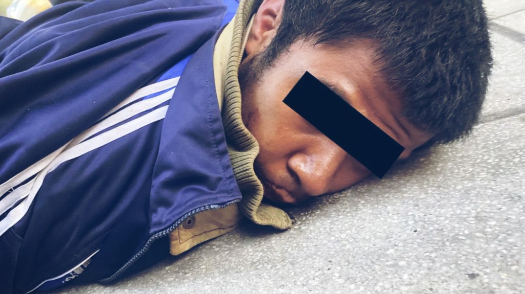 #CONMOCIÓN | ATACÓ A FIERRAZOS A UNA POLICÍA, LE ROBÓ EL ARMA REGLAMENTARIA Y DISPARÓ 10 VECES EN LA&nbsp;CALLE