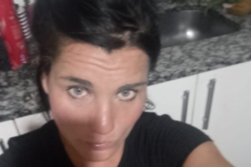 #TERRIBLE | ESPERABA EL COLECTIVO Y LE TIRARON ÁCIDO PARA ROBARLE LA&nbsp;CARTERA