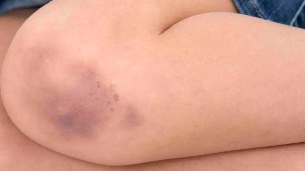 #BRUTAL | GOLPEÓ A SU HIJA DE 8 AÑOS CON UNA MADERA POR NO SABER EL&nbsp;ABECEDARIO