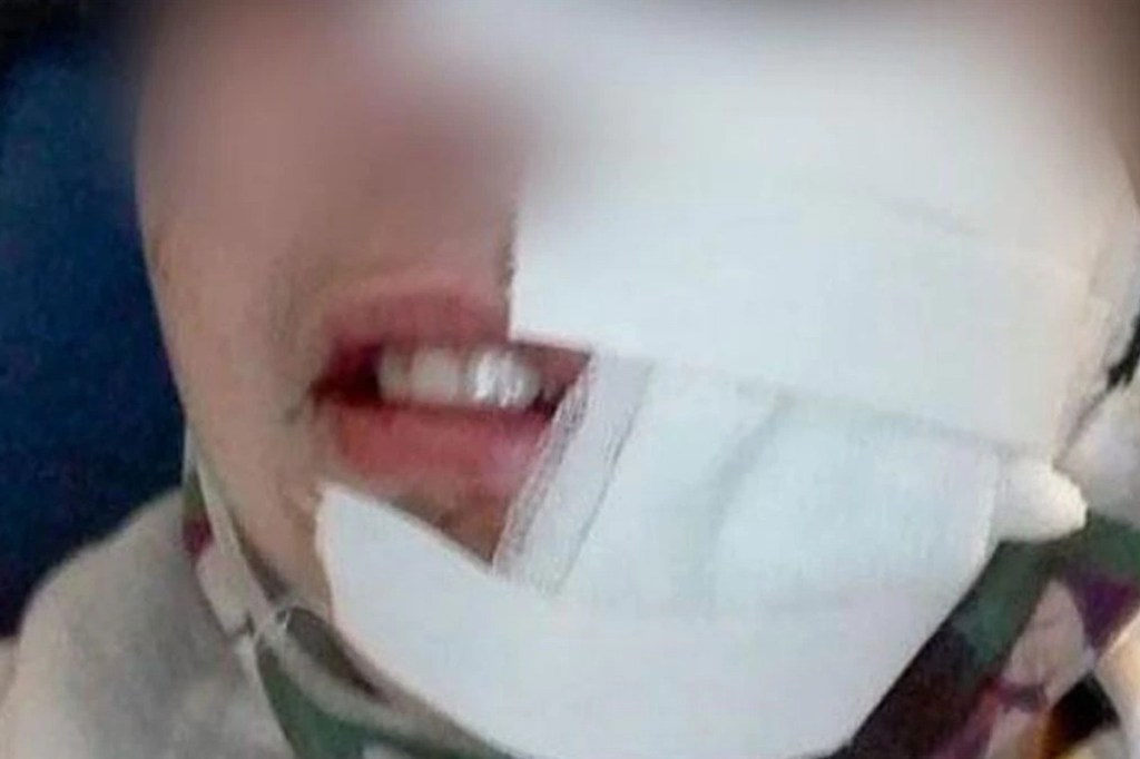 #HORROR | UN PITBULL ATACÓ A UN NENE EN UNA PLAZA Y LE DESFIGURÓ LA&nbsp;CARA