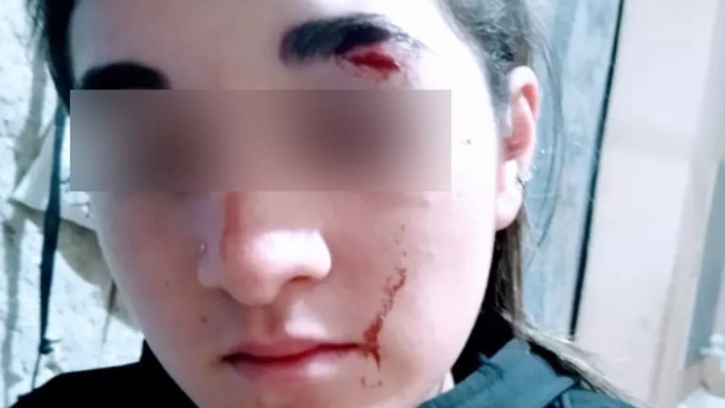 #POLICIALES | UNA PATOTA DE 15 PERSONAS GOLPEÓ SALVAJEMENTE A UNA CHICA DE 17 AÑOS QUE SE RESISTIÓ A QUE LE ROBARAN EL&nbsp;CELULAR