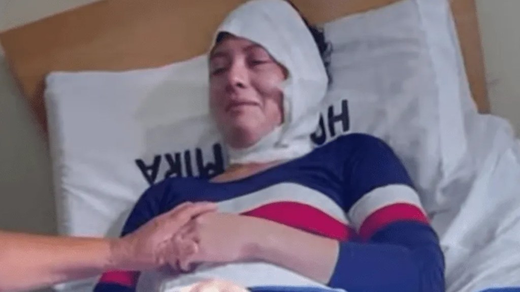 #HORROR | FUE A BUSCAR LA CUOTA ALIMENTARIA Y SU EX LA QUEMÓ CON ACEITE HIRVIENDO DELANTE DE SU HIJO DE 5&nbsp;AÑOS