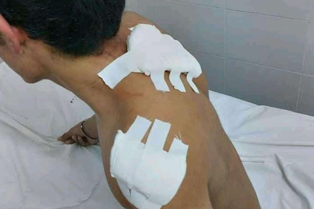 UN CHICO DE 16 AÑOS ATACÓ A PUÑALADAS A OTRO DE 14 PORQUE SE PUSO DE NOVIO CON SU&nbsp;HERMANA