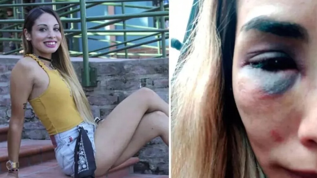 JOVEN POLICÍA FUE SECUESTRADA Y GOLPEADA SALVAJEMENTE POR SU&nbsp;EXNOVIO