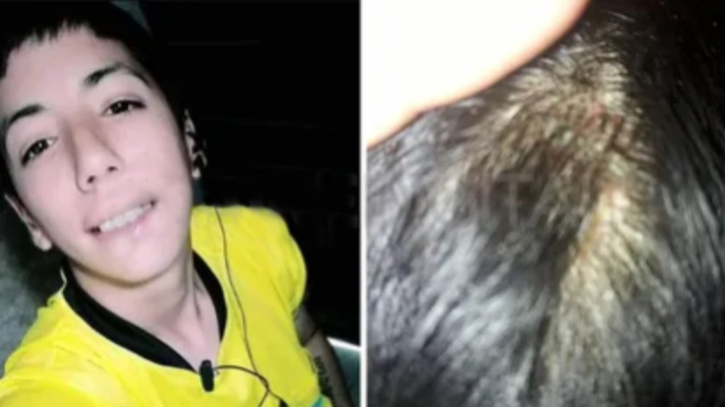Adolescente le dio una piña y varias patadas en la cabeza a una jueza de línea hasta dejarla&nbsp;inconsciente