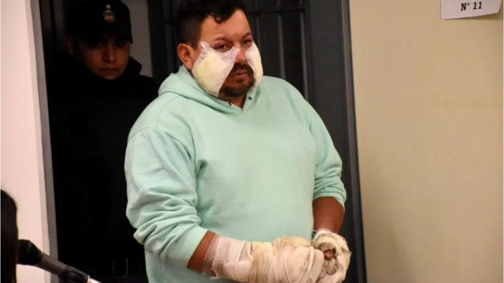 Prendió fuego a su mujer para matarla porque quería&nbsp;abandonarlo