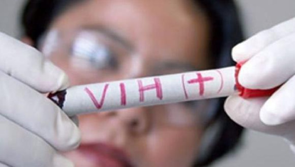 Más de 140 mil personas viven con VIH Sida en Argentina y no hubo descenso de la&nbsp;mortalidad