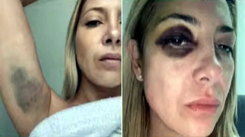 Alberto Fernández, violencia de género, Fabiola Yáñez, Julián Ercolini, Silvina Carreira, Juzgado Federal 10, Ramiro González, denuncia, expresidente, justicia argentina, causa judicial, terrorismo psicológico, irregularidades en contratos, violencia física, juicio mediático, causas penales