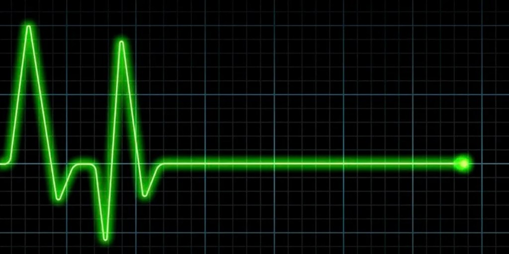 La importancia de la RCP y los desfibriladores automáticos para prevenir muertes&nbsp;súbitas