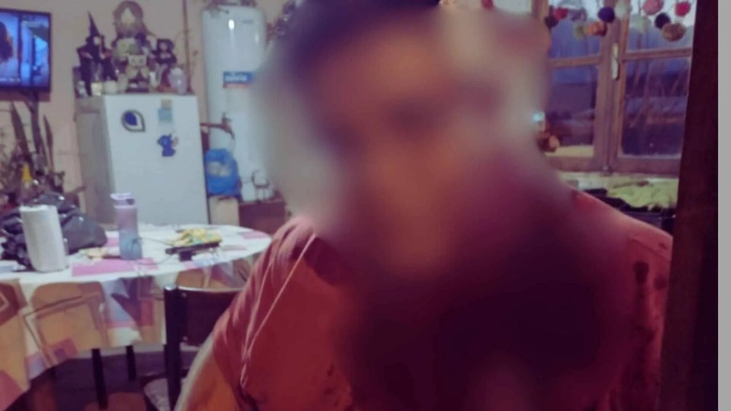 riña callejera, pelea familiar, barrio Ceferino Esquel, intervención policial, heridos en Esquel, disputa por celos, Esquel seguridad, conflicto familiar, violencia callejera, Esquel noticias