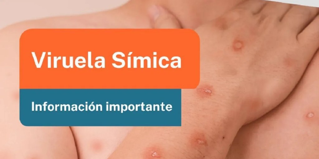 viruela símica, caso sospechoso, Comodoro Rivadavia, Hospital Regional, Instituto Malbrán, salud pública, Sergio Jaime, epidemia, protocolo sanitario, viruela del mono, transmisión viral, diagnóstico, nexo epidemiológico, cepa benigna, República Democrática del Congo, resultados